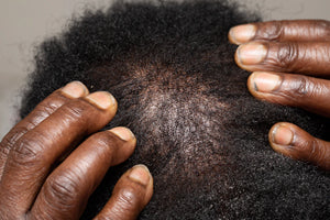 Unlocking the Secrets The Science Behind Hair Loss