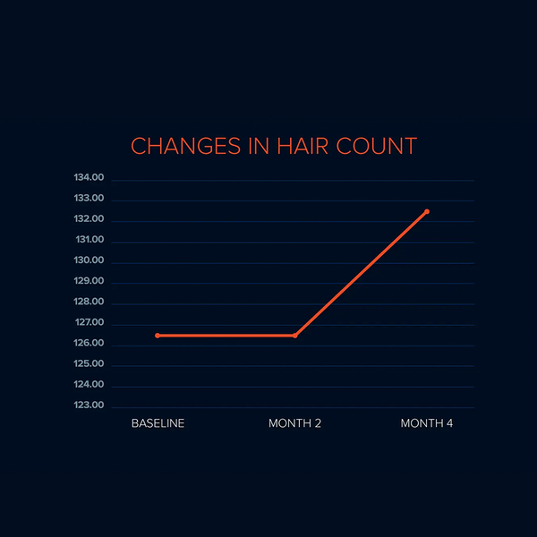 FOLIGAIN Triple Action Complete Formula For Thinning Hair For Women with 10% Trioxidil - FOLIGAIN